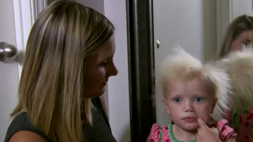 Una madre intenta peinar el cabello de su hija con el síndrome del cabello impeinable.
