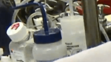 Una vez que se diagnostica, la tuberculosis es tratable.