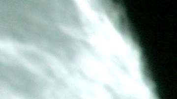 La terapia experimental promete resultados para combatir el cáncer de mama.