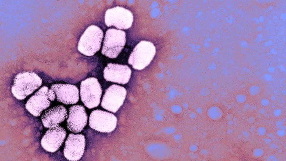 La FDA acaba de aprobar un medicamento para combatir la viruela.