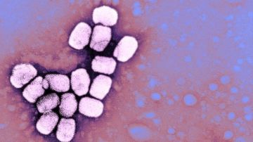 La FDA acaba de aprobar un medicamento para combatir la viruela.