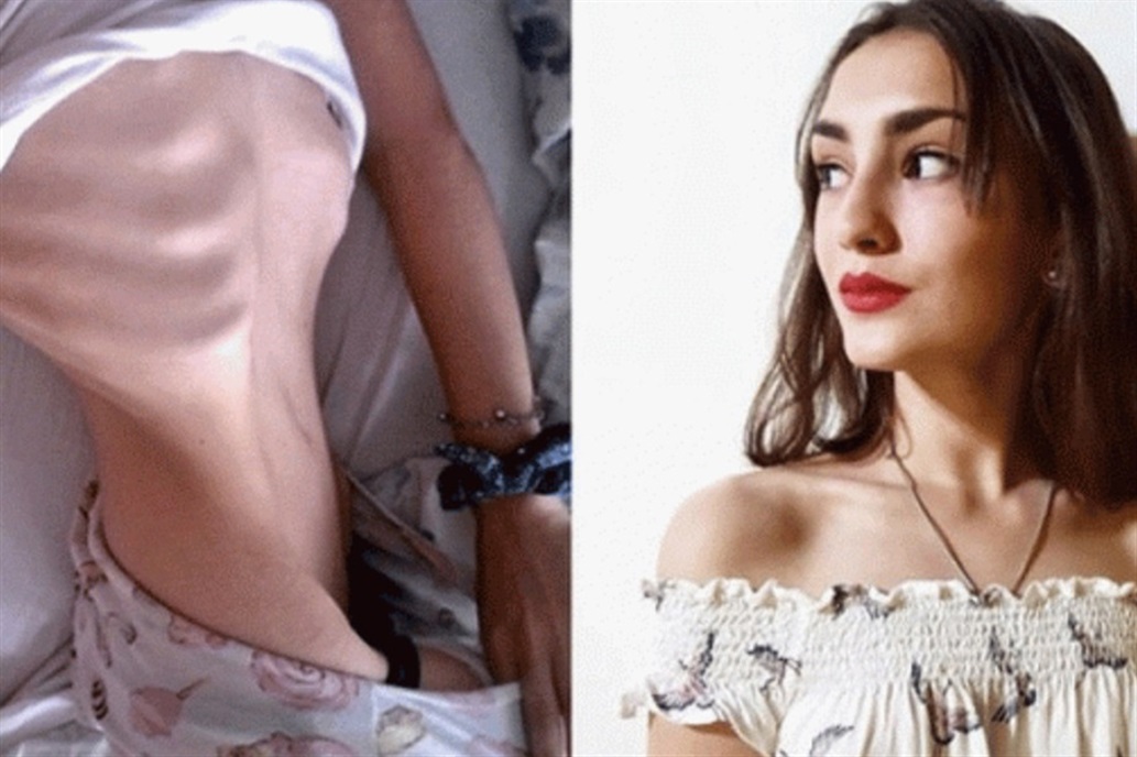 Impactante: el antes y el después de Camila.