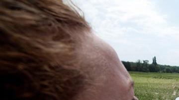 El ciclista australiano Simon Clarke fue uno de los afectados por el gas pimienta