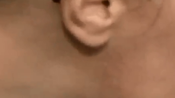 Gordon se está recuperando muy bien, pero el tratamiento es caro.