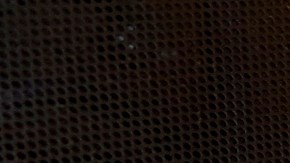 Israel Hernández y su novia Jully Romero muestran el disparo que impactó al mexicano, el cual dicen provino de un agente de la Policía de Los Ángeles durante un tiroteo cerca de su casa en Wilmington. (Aurelia Ventura/La Opinion)