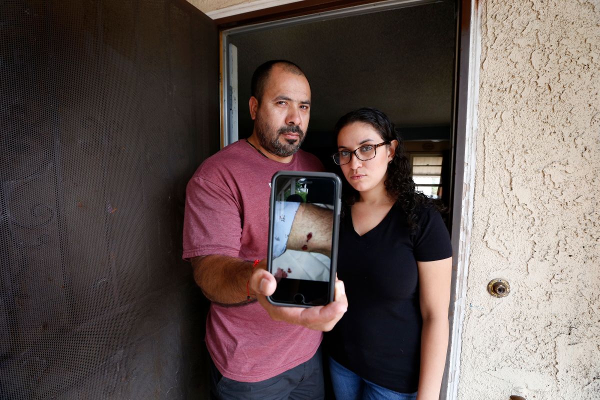 Israel Hernández y su novia Jully Romero muestran el disparo que impactó al mexicano, el cual dicen provino de un agente de la Policía de Los Ángeles durante un tiroteo cerca de su casa en Wilmington. (Aurelia Ventura/La Opinion)