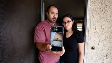Israel Hernández y su novia Jully Romero muestran el disparo que impactó al mexicano, el cual dicen provino de un agente de la Policía de Los Ángeles durante un tiroteo cerca de su casa en Wilmington. (Aurelia Ventura/La Opinion)