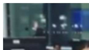 Johanna González Álvarez se sometió a la operación mientras se encontraba de vacaciones con sus hijos en Dominicana.