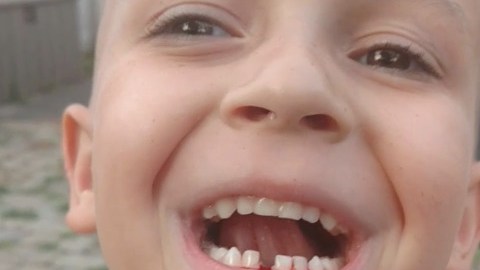 Un niño deja que su padre le arranque uno de sus dientes con un dron.