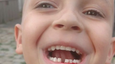 Un niño deja que su padre le arranque uno de sus dientes con un dron.