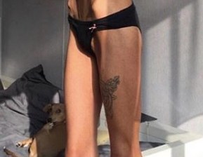 Una víctima de anorexia.