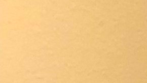 Víctor Espinoza se recupera de fractura de cuello en su casa de Del Mar, California.