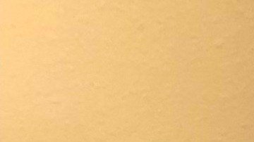 Víctor Espinoza se recupera de fractura de cuello en su casa de Del Mar, California.