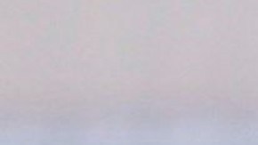 Cristiano Ronaldo entrenó con la Juventus con el ojo morado