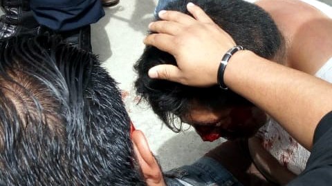 Linchan a funcionario en el municipio de Metepec, en Hidalgo.