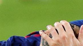 Lionel Messi sugrió una grave lesión en el codo del brazo derecho