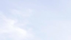 Diego Armando Maradona padece artrosis y ya no tiene castílagos en las rodillas