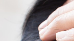 Mujer con problema de cabello