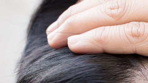 Mujer con problema de cabello