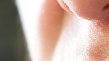 herpes labial