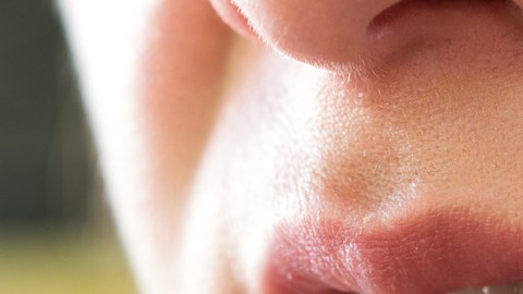 herpes labial
