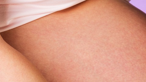 fecundación in vitro