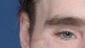 Cameron Underwood con el rostro reconstruido