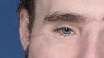 Cameron Underwood con el rostro reconstruido