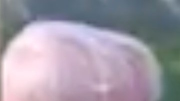 Un niño reconoce la anomalía congénita que padece en otra chica y se acerca a ella.