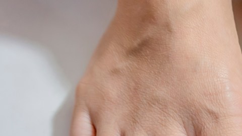 hongos uñas pies