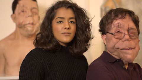 Mientras hacía el documental, Arooj Aftab conoció a Adam Pearson, que también padece NF1.