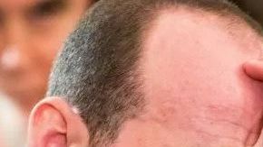 Stephen Miller aparentemente utilizó cabello en spray.