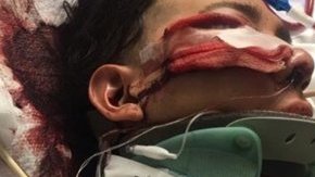 Luis López de 18 años quedó inconsciente tras un golpe en la cabeza