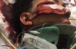 Luis López de 18 años quedó inconsciente tras un golpe en la cabeza