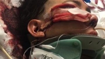 Luis López de 18 años quedó inconsciente tras un golpe en la cabeza