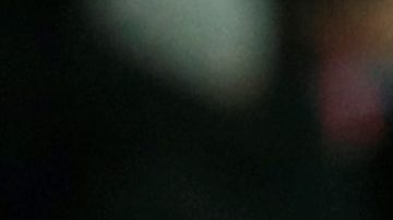 Neymar se resintió de la lesión de 2018 en el quinto metatarso del pie derecho.