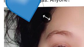 Solo quería trenzarse en el pelo a pesar de estar en el hospital.