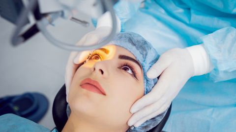 cirugia LASIK de ojos