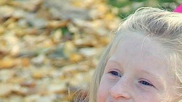 síndrome-de-angelman-1