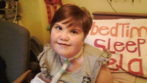 Shauna Davison nació con problemas respiratorios y cardiacos.