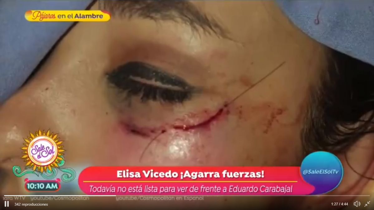 Elisa Vicedo sufiró heridas.