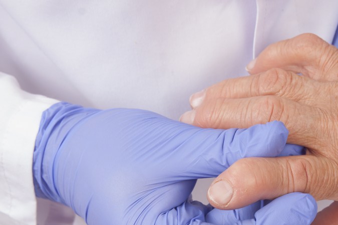artritis reumatoide