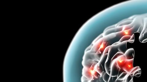 cerebro