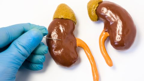 biopsia renal