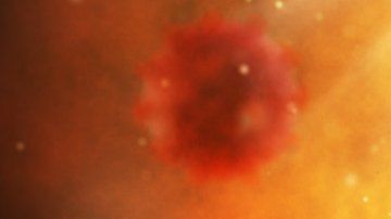 Tras el trasplante de células madre, y una terapia muy agresiva, no se ha detectado rastros del virus en el cuerpo del paciente.