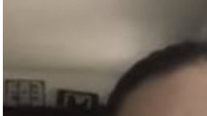 Cirugías Meghan Markle