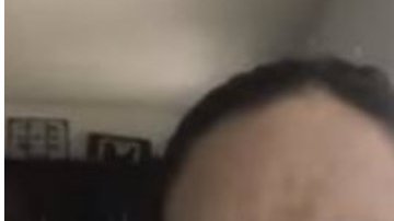 Cirugías Meghan Markle