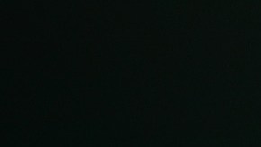 Hisopos infección cerebral