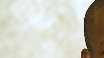 Un hombre se opera los genitales debido a su excesivo tamaño.