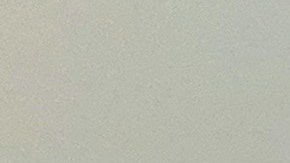 Shannon Collins sufrió quemaduras de tercer grado en sus brazos y espalda a causa de un calentador portátil. (Jacqueline García)